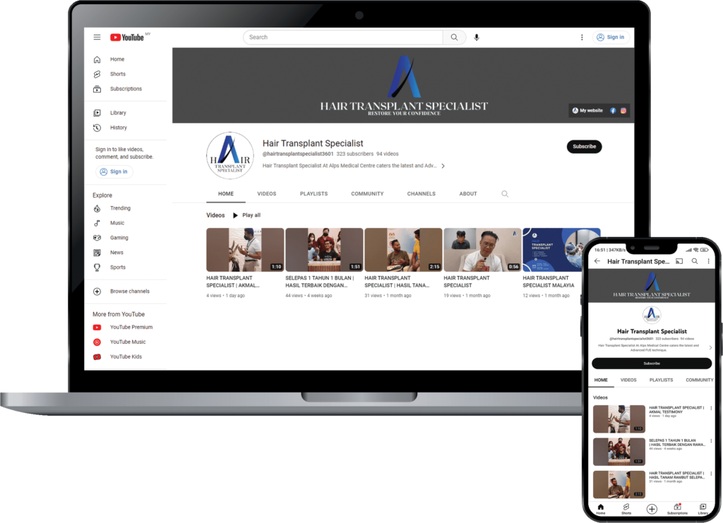 Laptop and smartphone showcasing ‘Hair Transplant Specialist’ YouTube channel.
