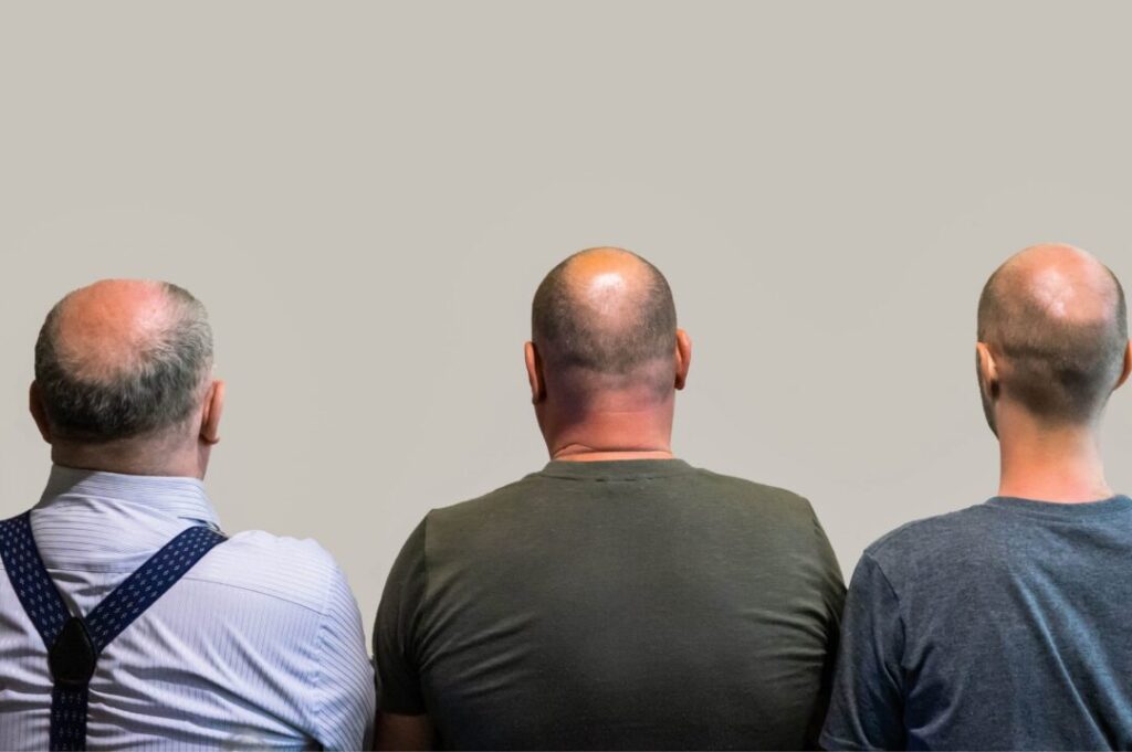 Visual comparison of different hair types influenced by genetic traits.