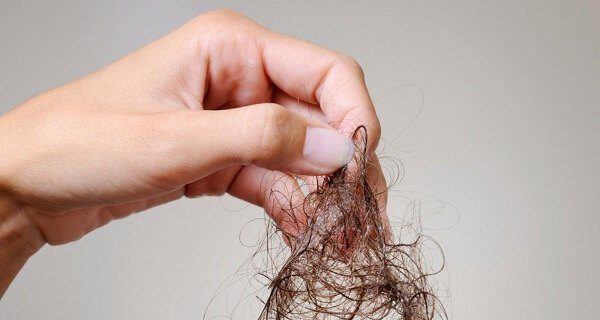 Visual representation of normal daily hair loss, with strands scattered on a brush.